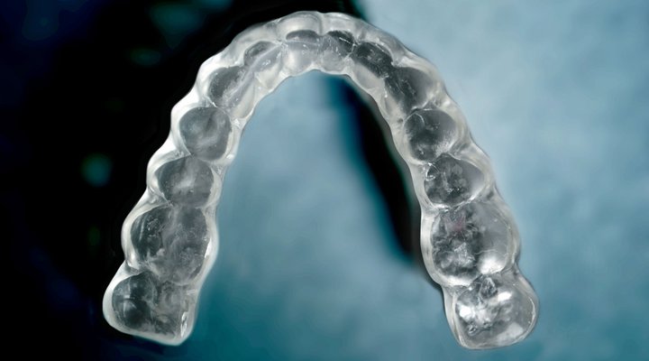 Eine Knirscherschiene entlastet Zähne & Muskulatur und schützt die Zahnsubstanz.